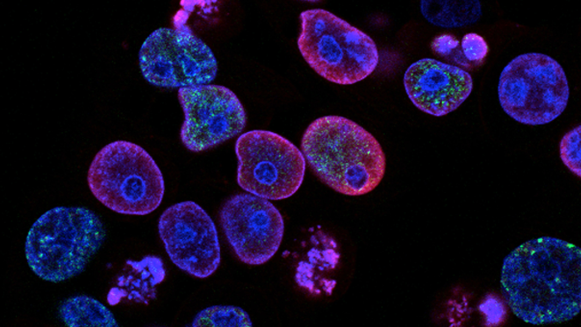 THE ULTIMATE GUIDE: HOW TO IMPROVE YOUR IMMUNE SYSTEM NATURALLY
