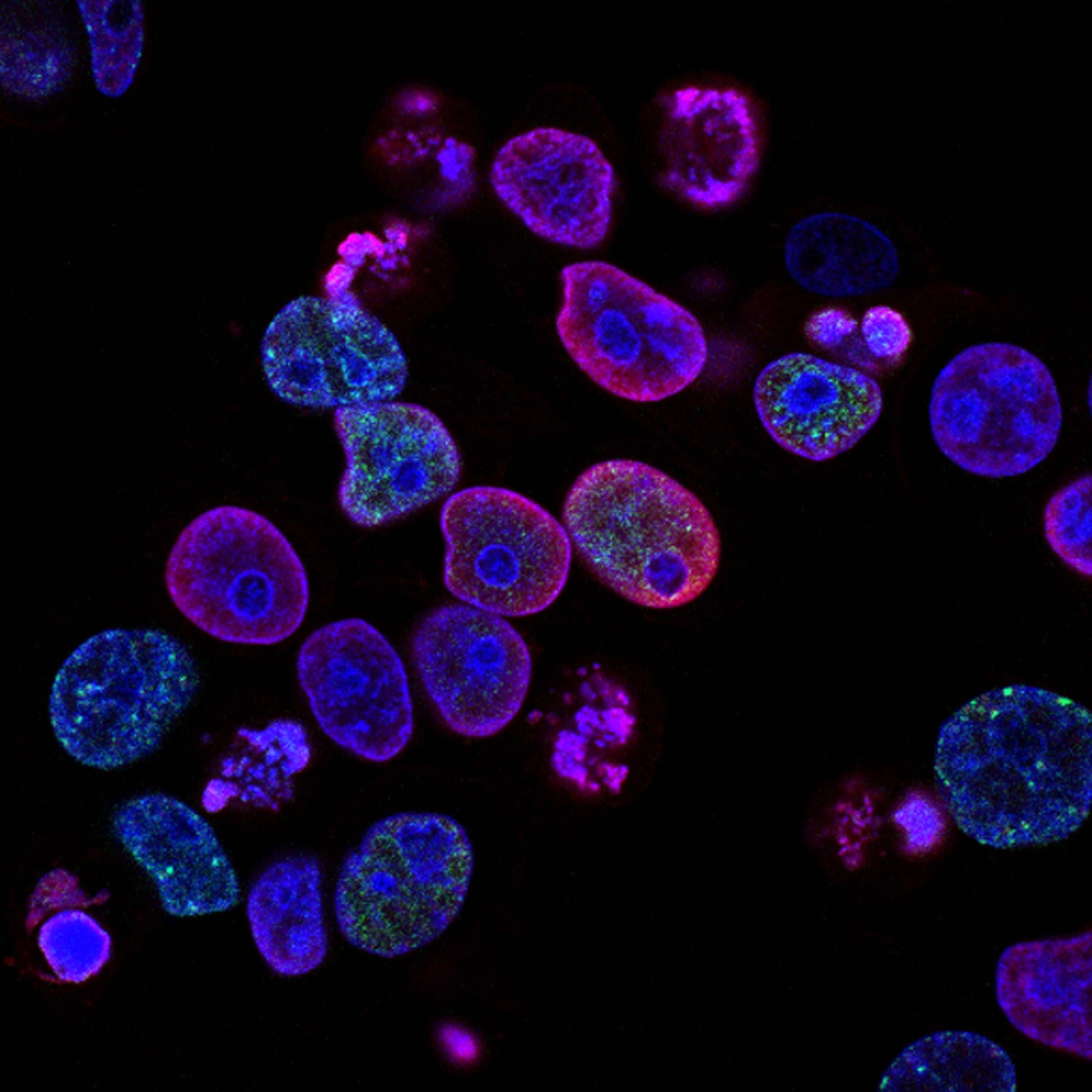 Natural Killer Cells Immune System